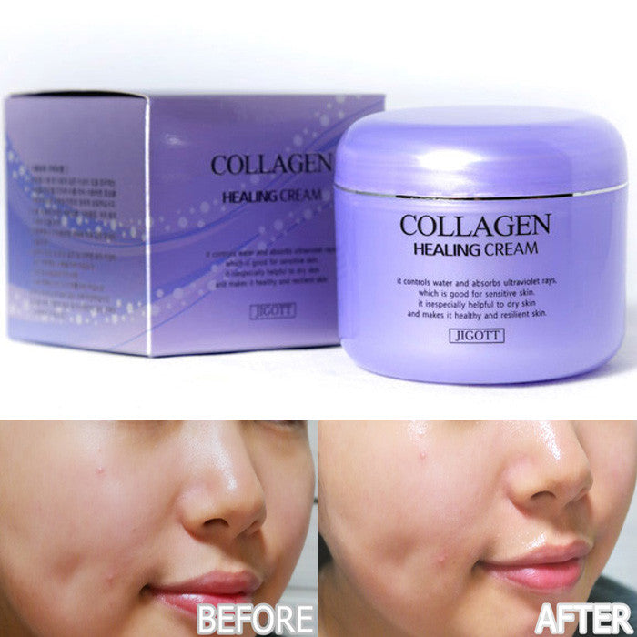 KOREA BEST SKIN CARE Whitening Cream+Snail Cream+Collagen Cream Korean Cosmetics